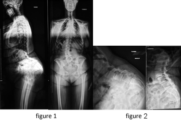 figure1-2